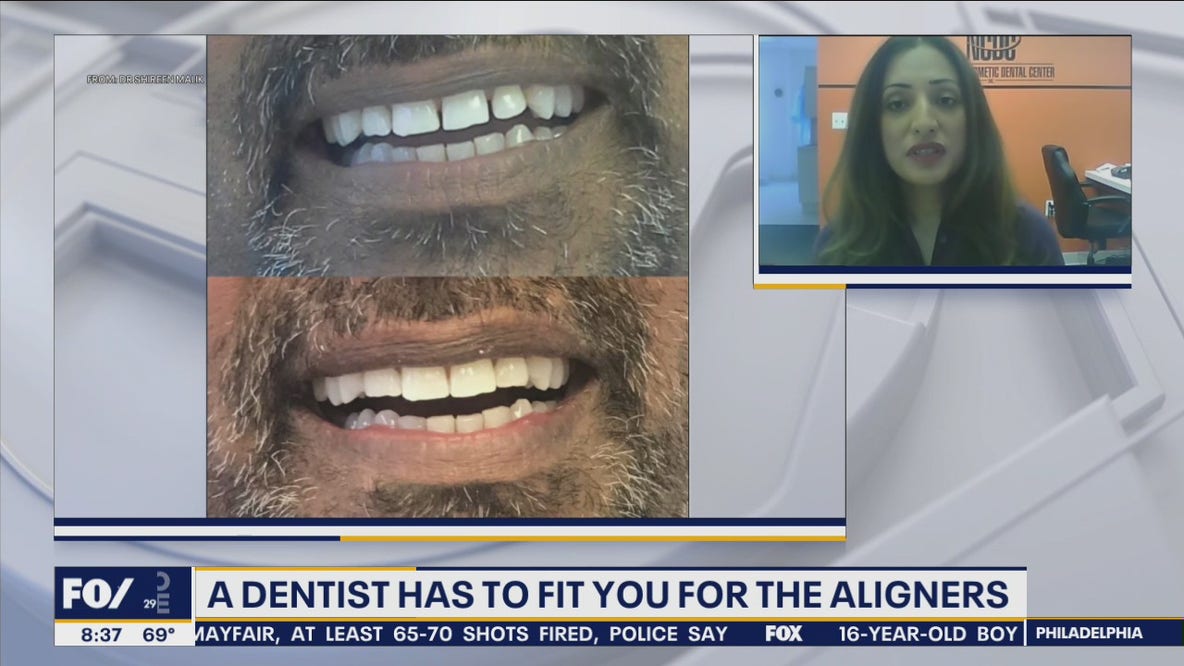 More adults want to align their teeth